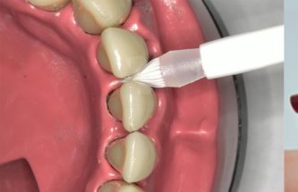 MICROBRISTLE APPLICATOR (MBA™) SYSTEMS FOR TOPICAL AND TRANSDERMAL DRUG APPLICATION