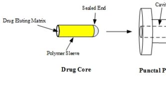 THERAPY WITHOUT DROPS: A REALITY