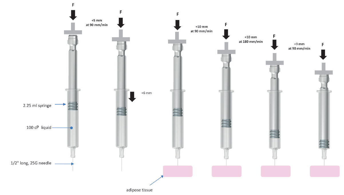 ADJUSTING & CONTROLLING INJECTION SPEED BY DESIGN: IMPACT ON PAIN ...