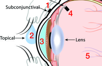 IMPROVING OUTCOMES IN OPHTHALMOLOGY VIA SUSTAINED DRUG DELIVERY