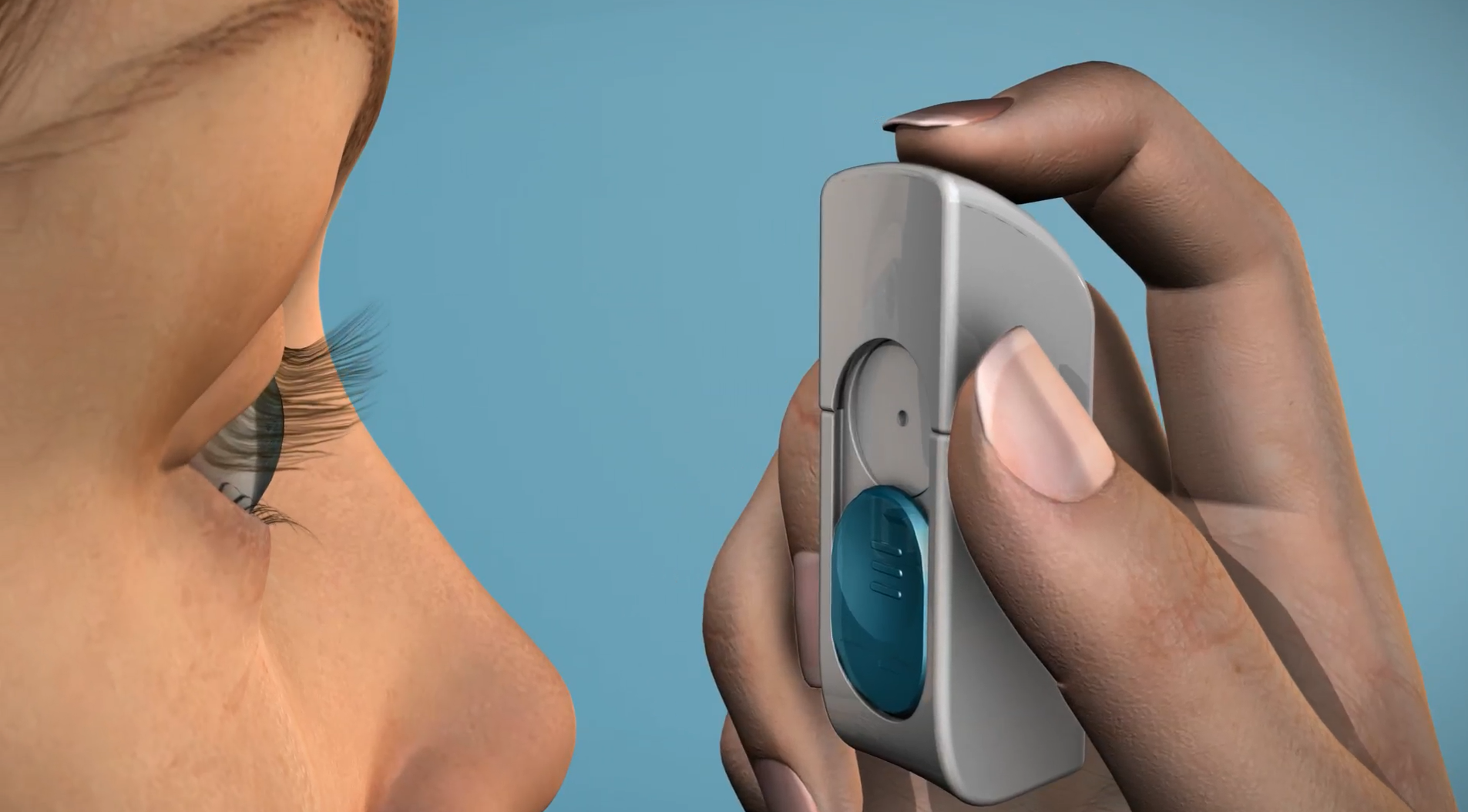 ACUSTREAM™ BRINGING TOPICAL OPHTHALMIC DRUG DELIVERY INTO THE MODERN