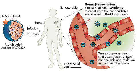 Figure 2: Clinical visualisation of tumour uptake. The radiolabelled CPC634 carries an 89Zr PET label enabling non-invasive imaging by PET/CT scans.