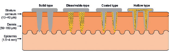 Figure 1: Schematic illustration of various needle forms.