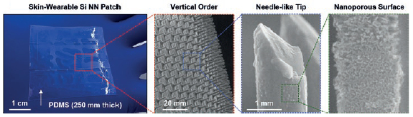 Figure 2: Photograph of a representative Si NN-patch (left) and magnified images of the tips and the nanoporous surface.