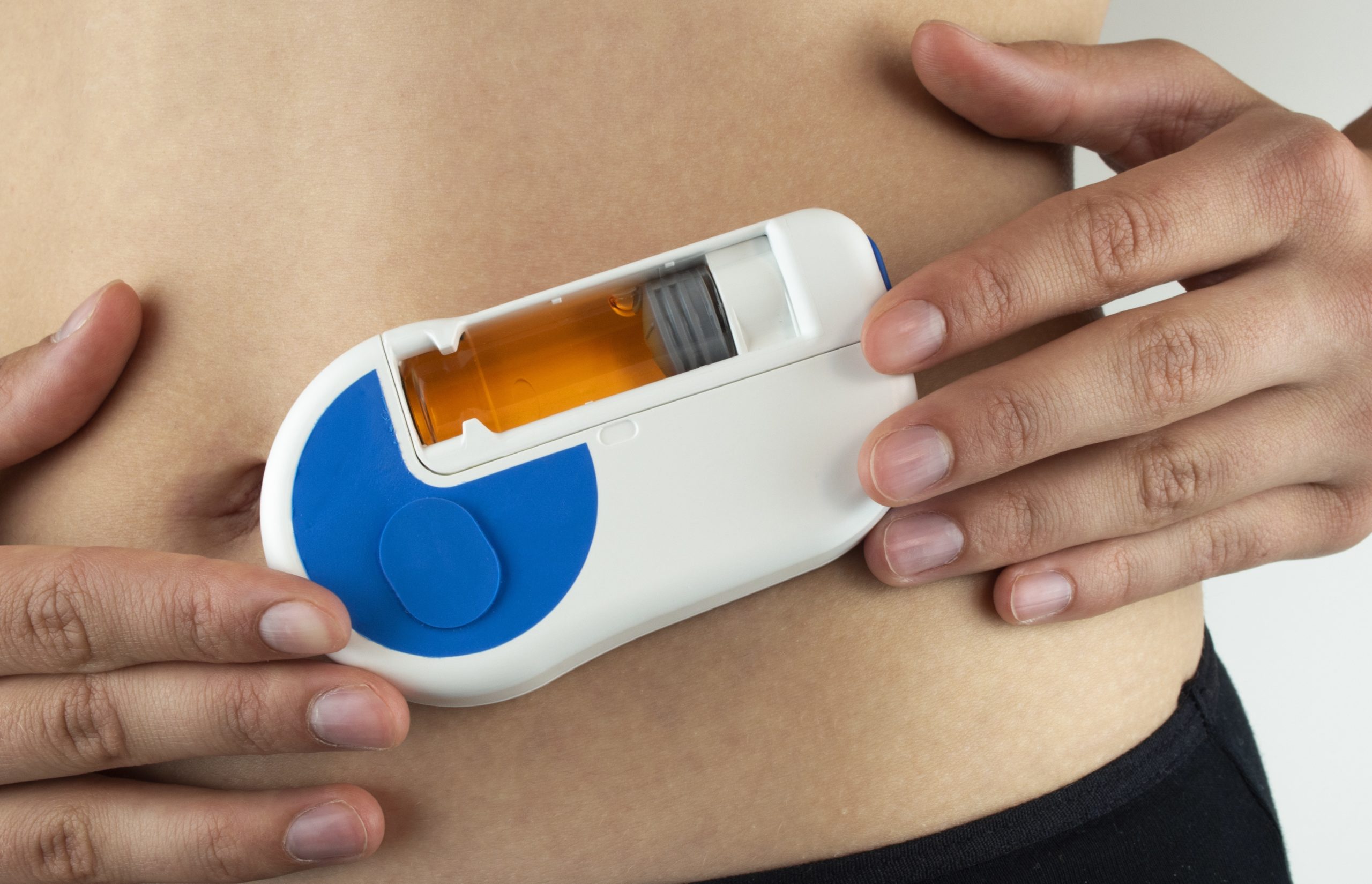 NEXTGENERATION WEARABLE DELIVERY DEVICES FOR LARGEVOLUME BIOLOGICS