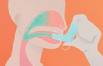 RETRONOSE: IMPROVING NASAL DELIVERY THROUGH A NEW AND IMPROVED DEVICE