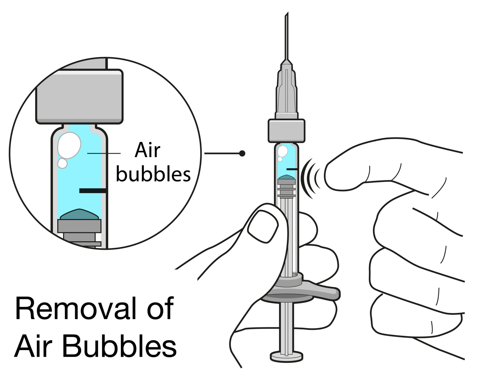 DRUG DELIVERY TO THE EYE THE CHALLENGES OF INTRAVITREAL