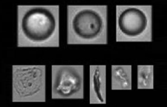 HOW TEN23 HEALTH IS MEETING DEVELOPMENTAL CHALLENGES FOR INTRAVITREAL PRODUCTS