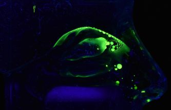 NOSE-TO-BRAIN DRUG ADMINISTRATION AND A NOVEL APPROACH WITH AN OLD FAMILIAR