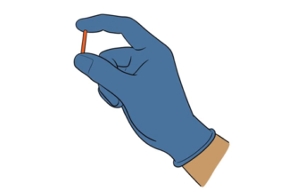 DRUG DELIVERY PLATFORM DRIVES NEW OPPORTUNITIES FOR CONTINUOUS-DELIVERY GLAUCOMA TREATMENT