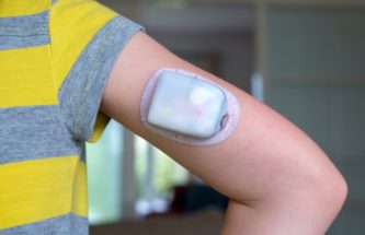 INCORPORATING MOTION DESIGN AT EARLY STAGES OF WEARABLE INJECTOR DEVELOPMENT