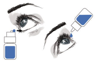 ACCURATE DELIVERY & PRECISE DOSING OF EYE DROPS: WHAT IF WE CHANGE THE INSTILLATION PROCEDURE?