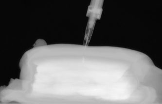 THE PLATFORM PARADOX: DEVICE DEVELOPMENT CHALLENGES WITHIN FAST EVOLVING DRUG DISCOVERY PIPELINES